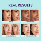 SupremeCrème – Hydrating 3-in-1 Concealer