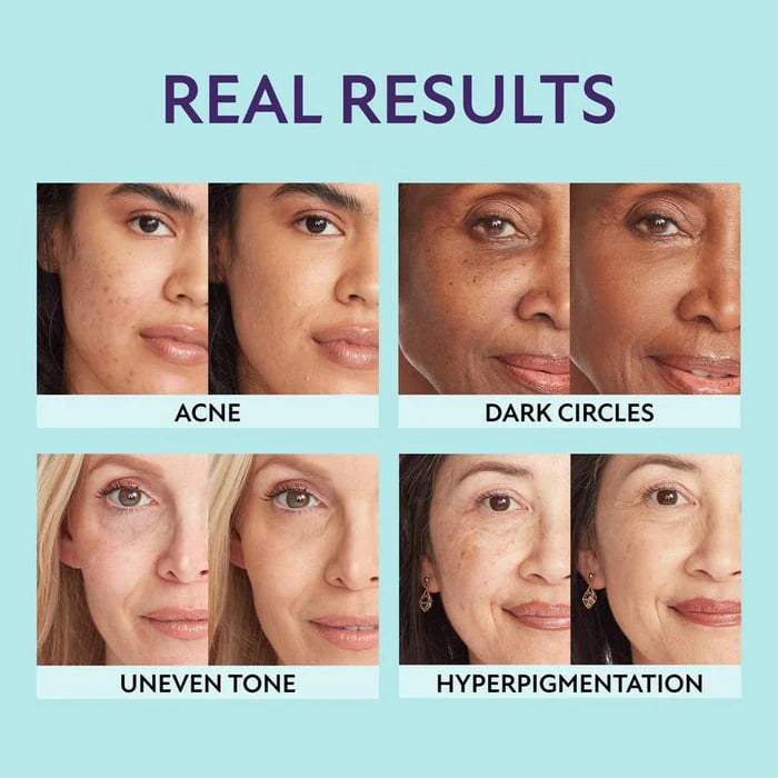 SupremeCrème – Hydrating 3-in-1 Concealer