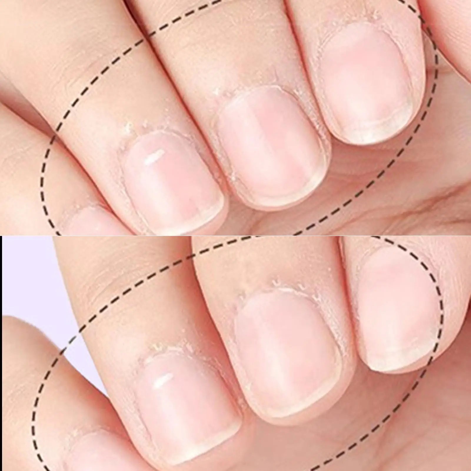 NailSoothe Oil Pen