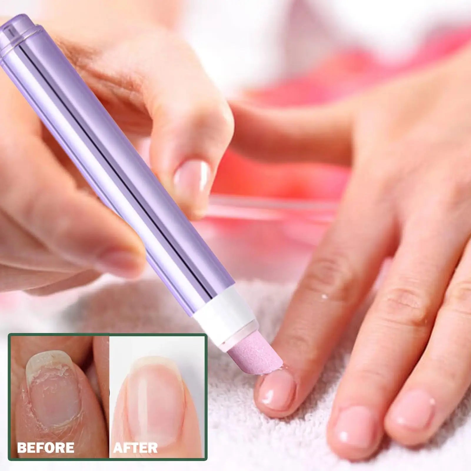 NailSoothe Oil Pen